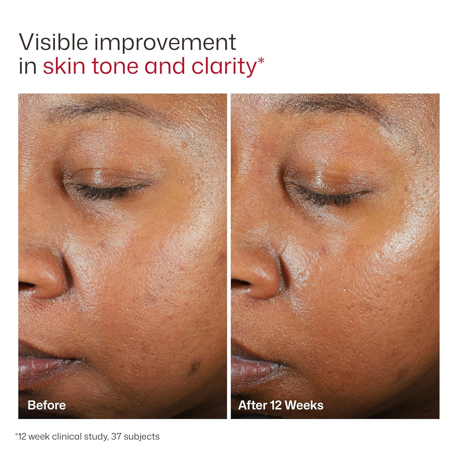 ace Sunscreen, Oil-Free Face Moisturizer with SPF 46, Dermatology