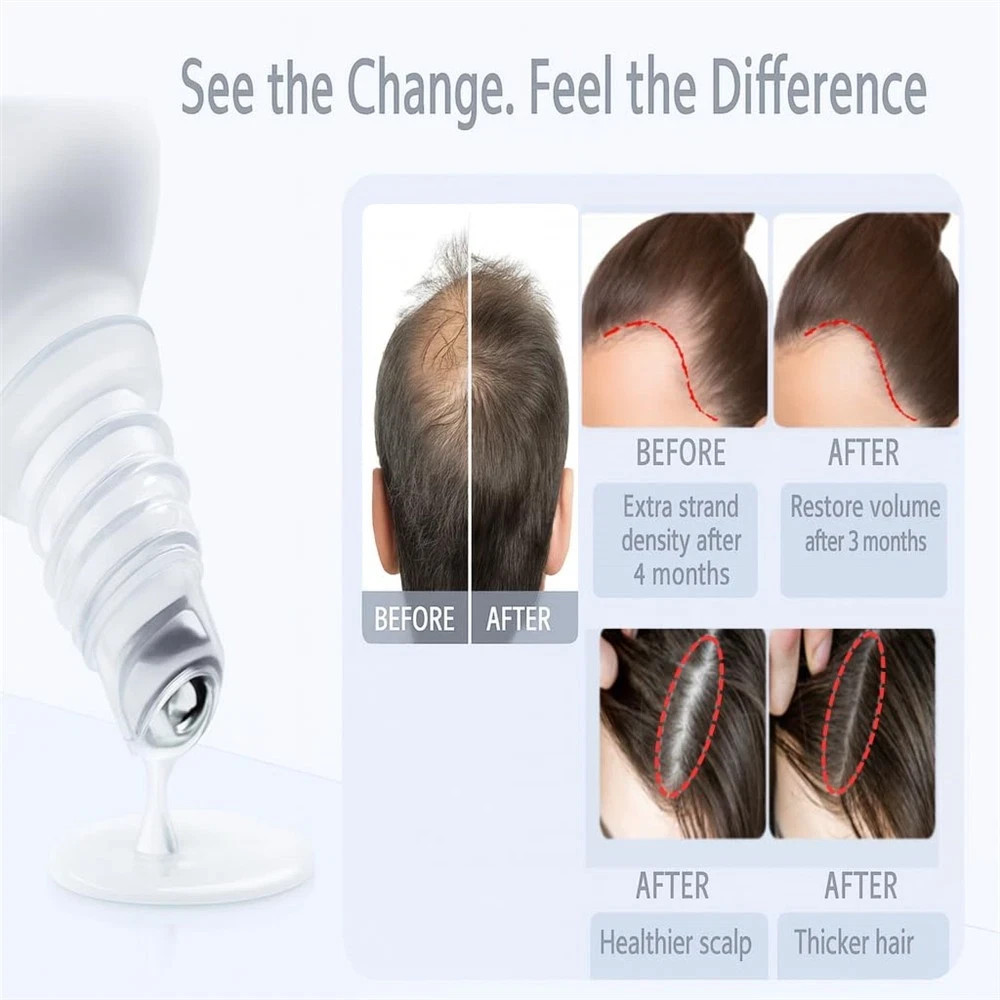 Be Bodywise Hair Growth Serum Roll On – 3% Rosemary, 3% Redensyl & 2% – 2025🔥