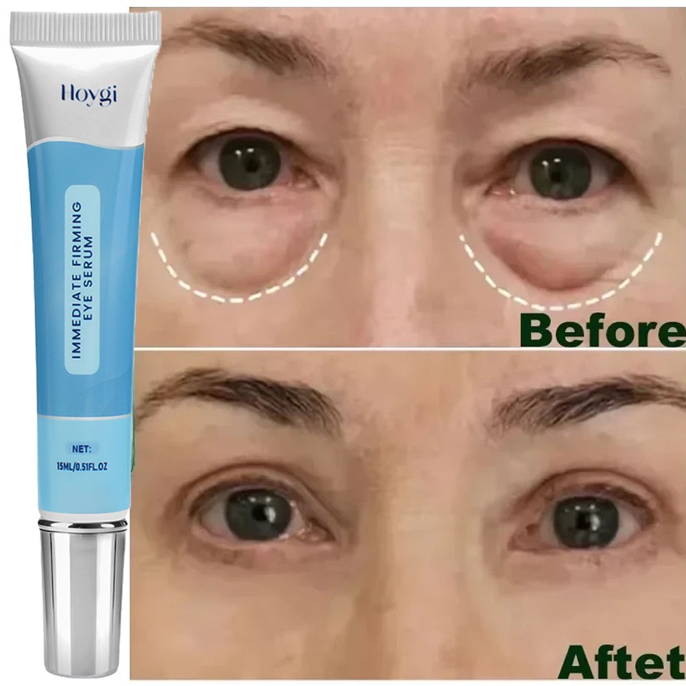 Eye Cream Instant Remove Eye Bags Dark Circles Anti Wrinkle Depuffing Firming US