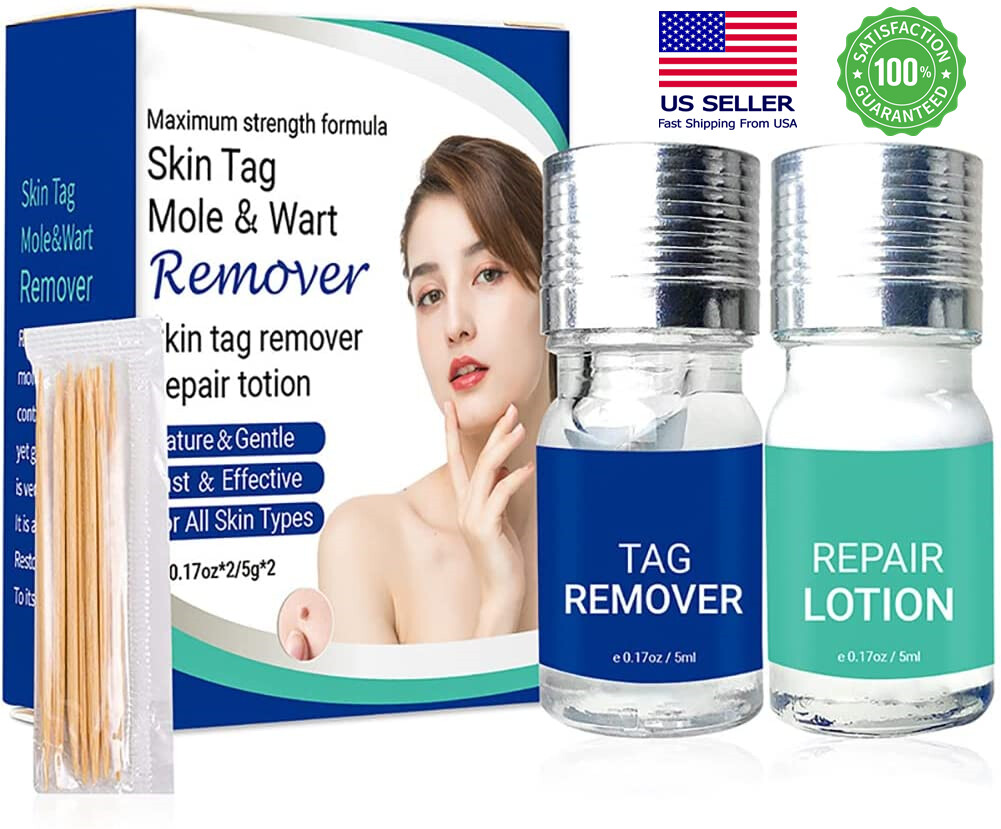 Skin Tag Remover and Repair Liquid Mole Corrector Wart Skin Tag Foot Corn remove