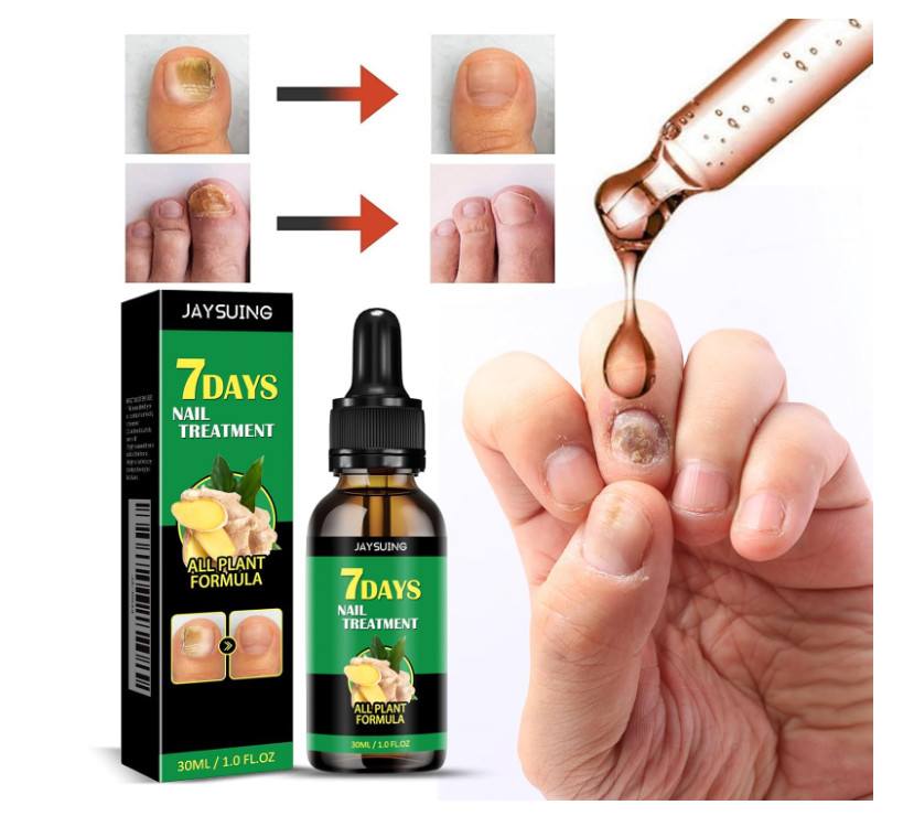 7-Day Toenail Fungus Treatment (2 Pack) Extra Repair for Discolored Nails 30MLx2