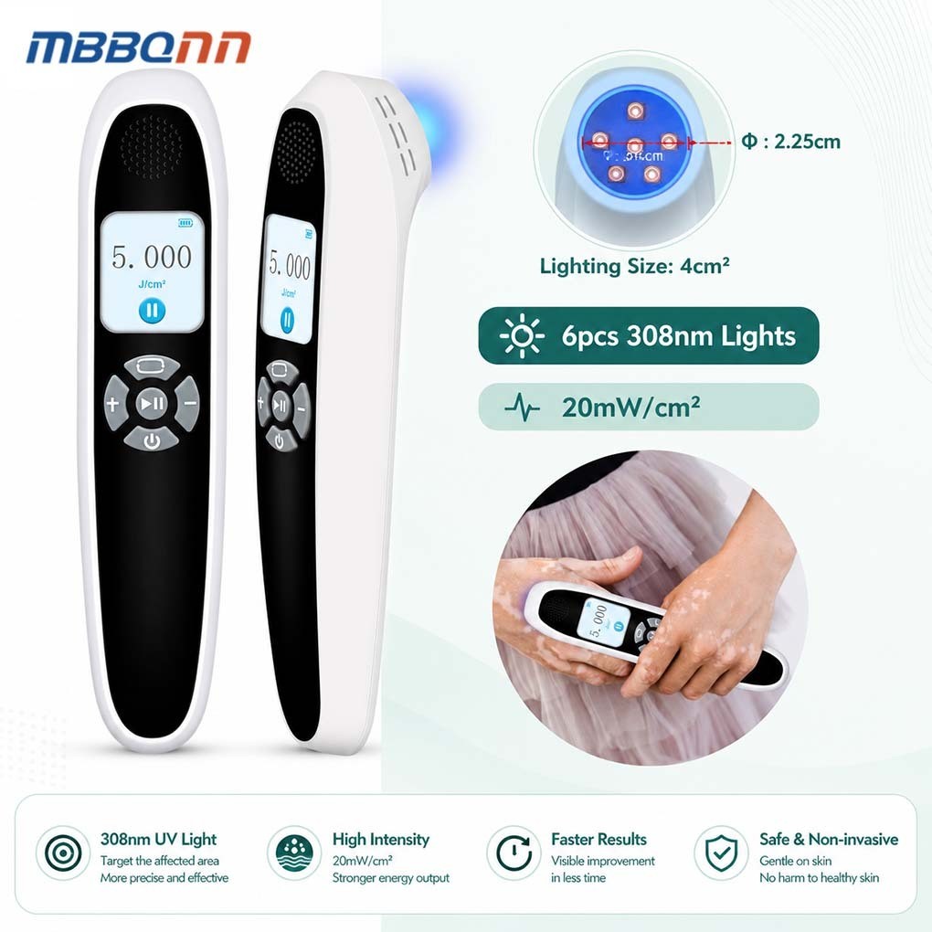 Handheld 308nm UVB Phototherapy Light for Face and Body Skin Wellness Home Use