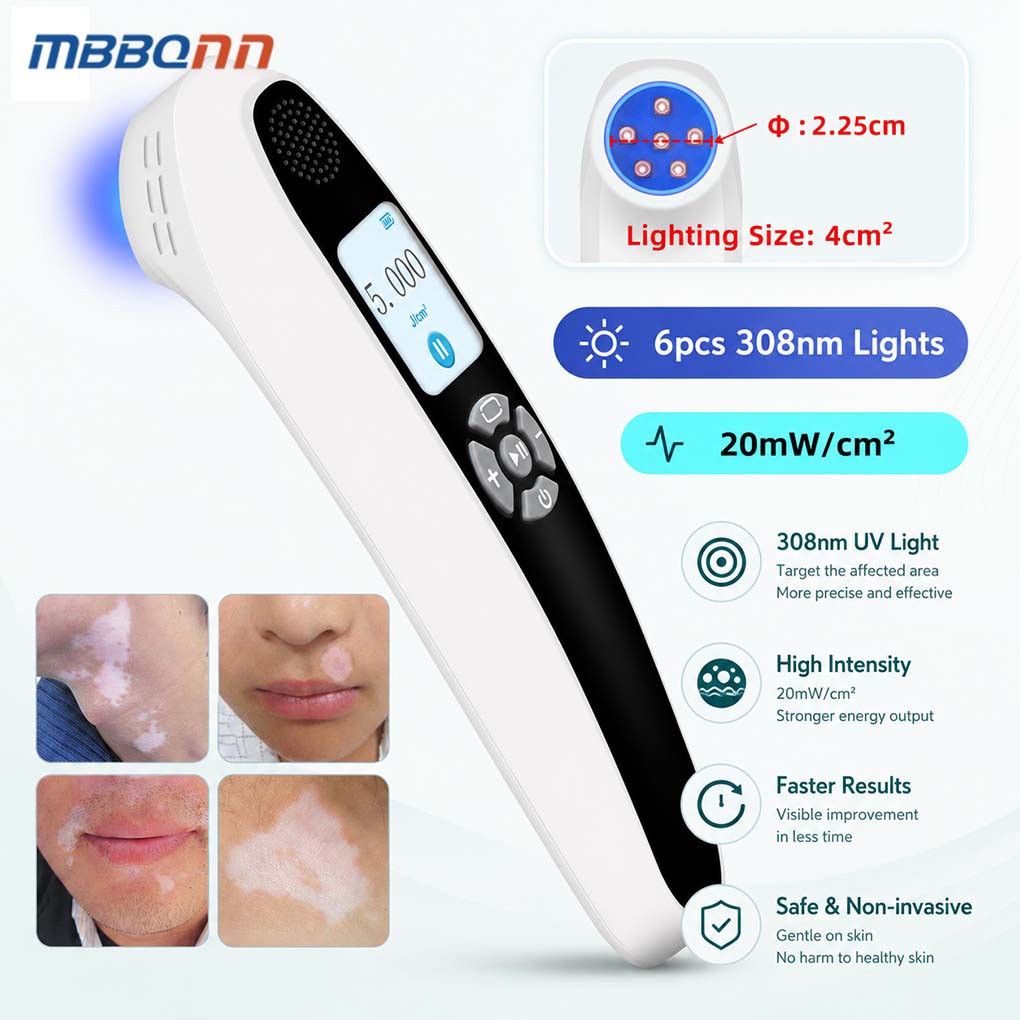 High Efficiency 308nm UVB Light Therapy Device for Skin Repair and Even Tone