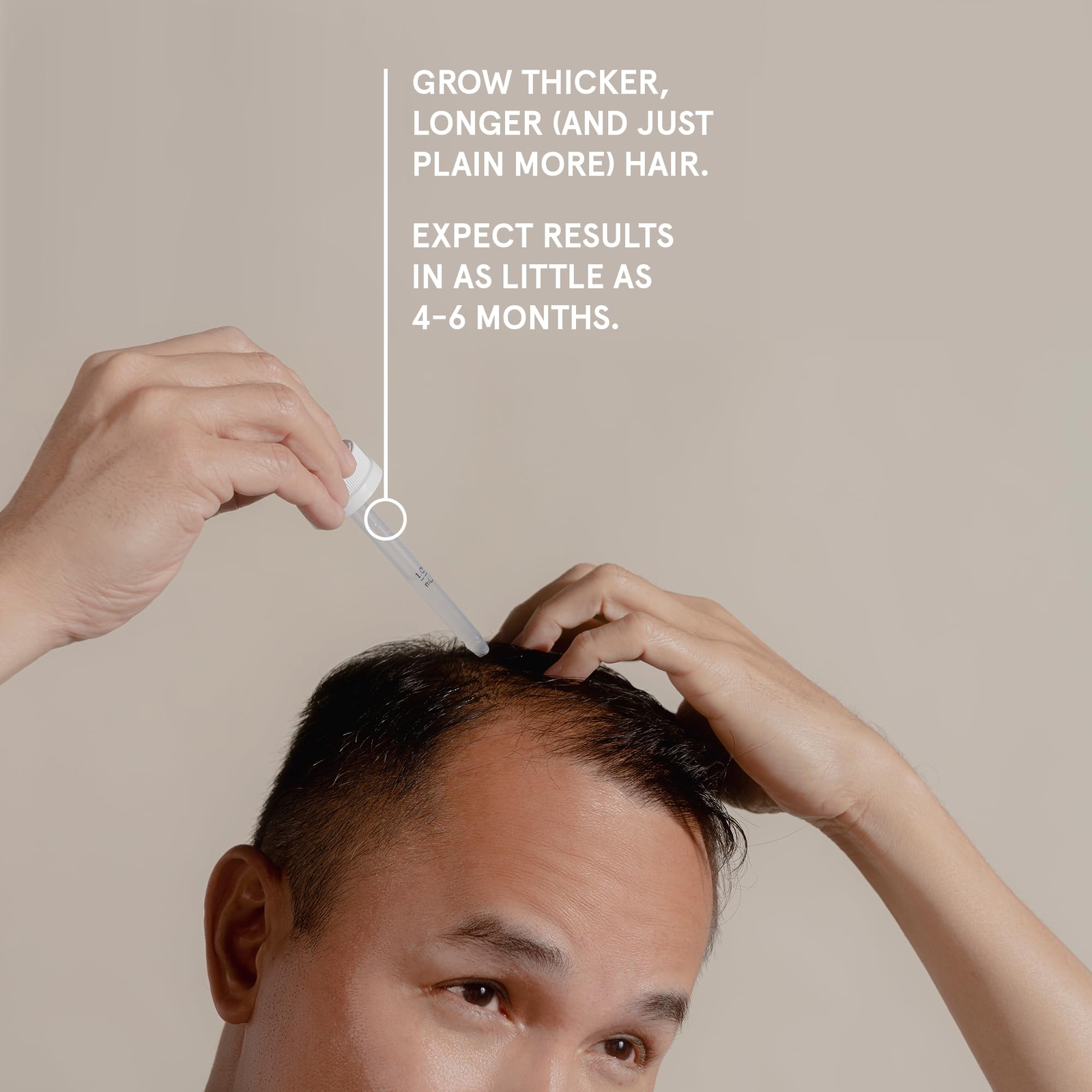 Keeps Extra Strength Minoxidil for Men Topical Hair Growth Serum 5% Solution