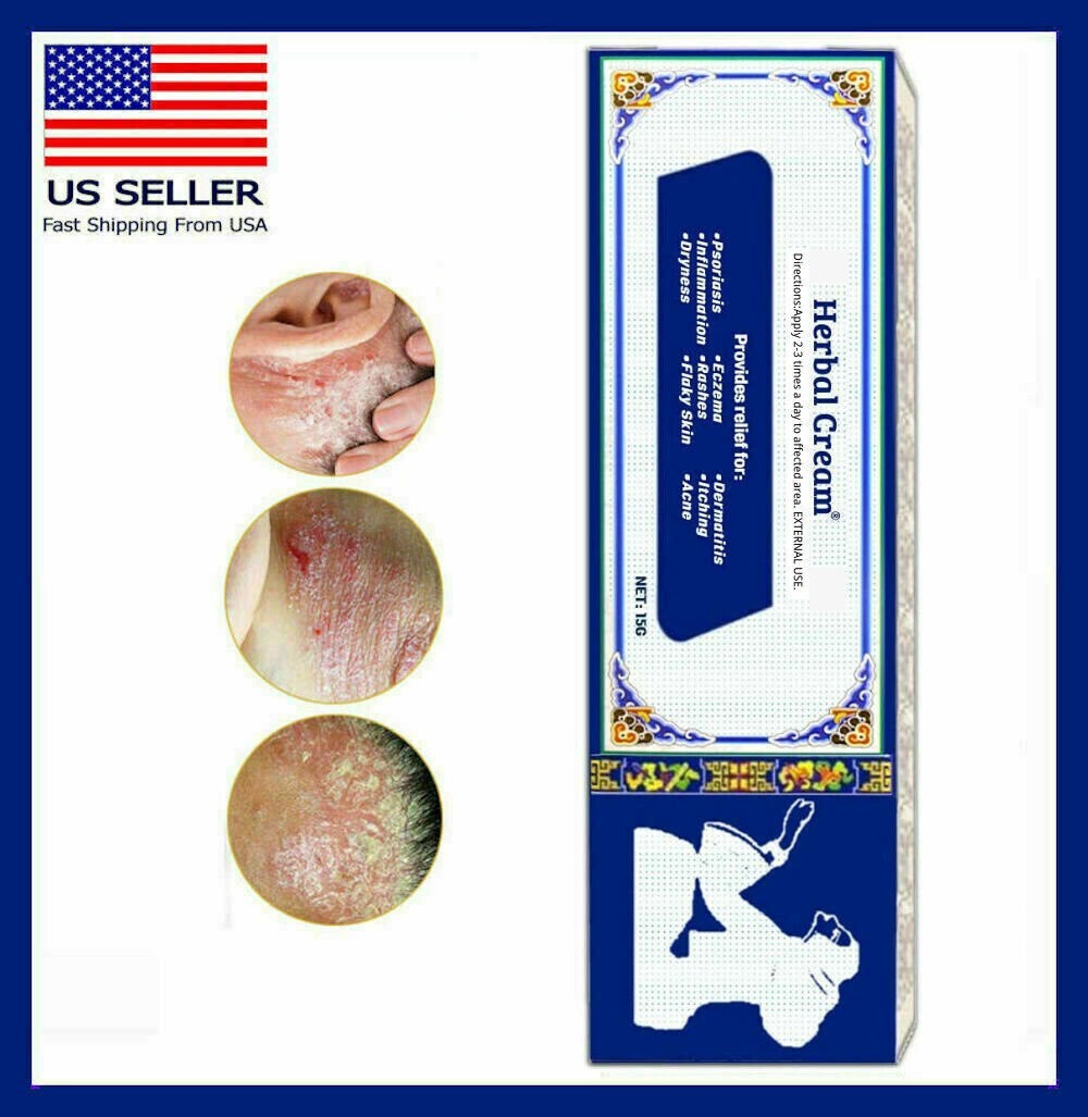SKIN OINTMENT BODY PSORIASIS DERMATITIS ECZEMA NATURAL TREATMENT CREAM 15G