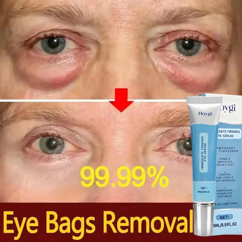 Under Eye Cream Remove Dark Circles Bags Face Lines Wrinkles Ageless Puffy Eye