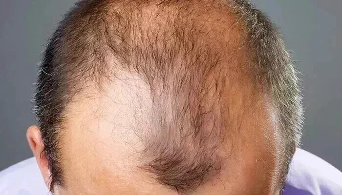 Reroot Professional Strength Veganic Natural Hair Growth Dietary Supplements