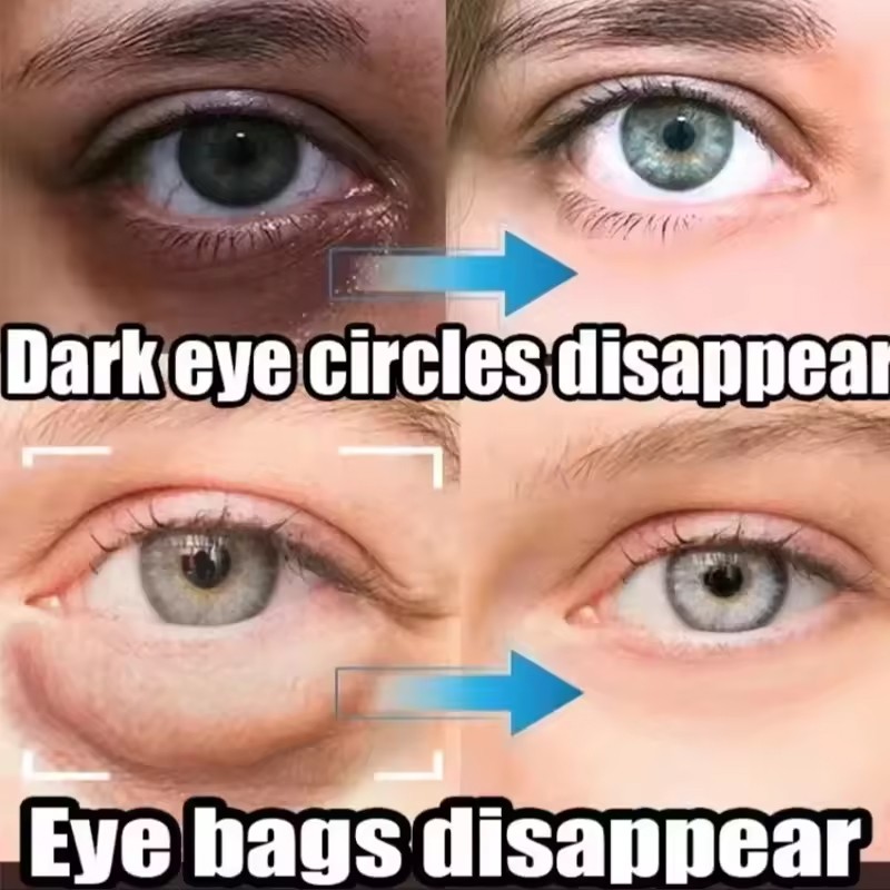 Under Eye Cream Remove Dark Circles Bags Face Lines Wrinkles Ageless Puffy Eye