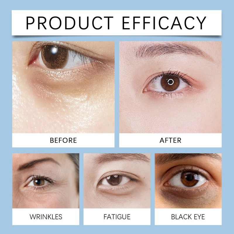 Under Eye Cream Remove Dark Circles Bags Face Lines Wrinkles Ageless Puffy Eye