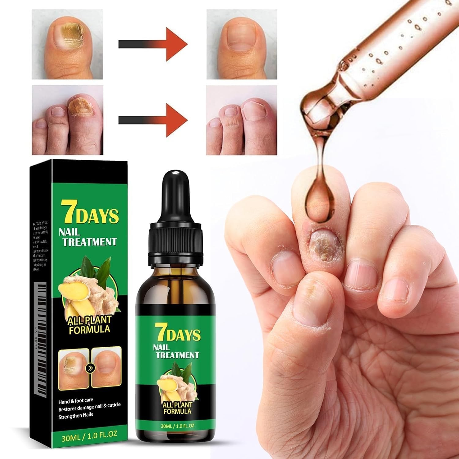 7-Day Toenail Fungus Treatment (2 Pack) Extra Repair for Discolored Nails 30MLx2