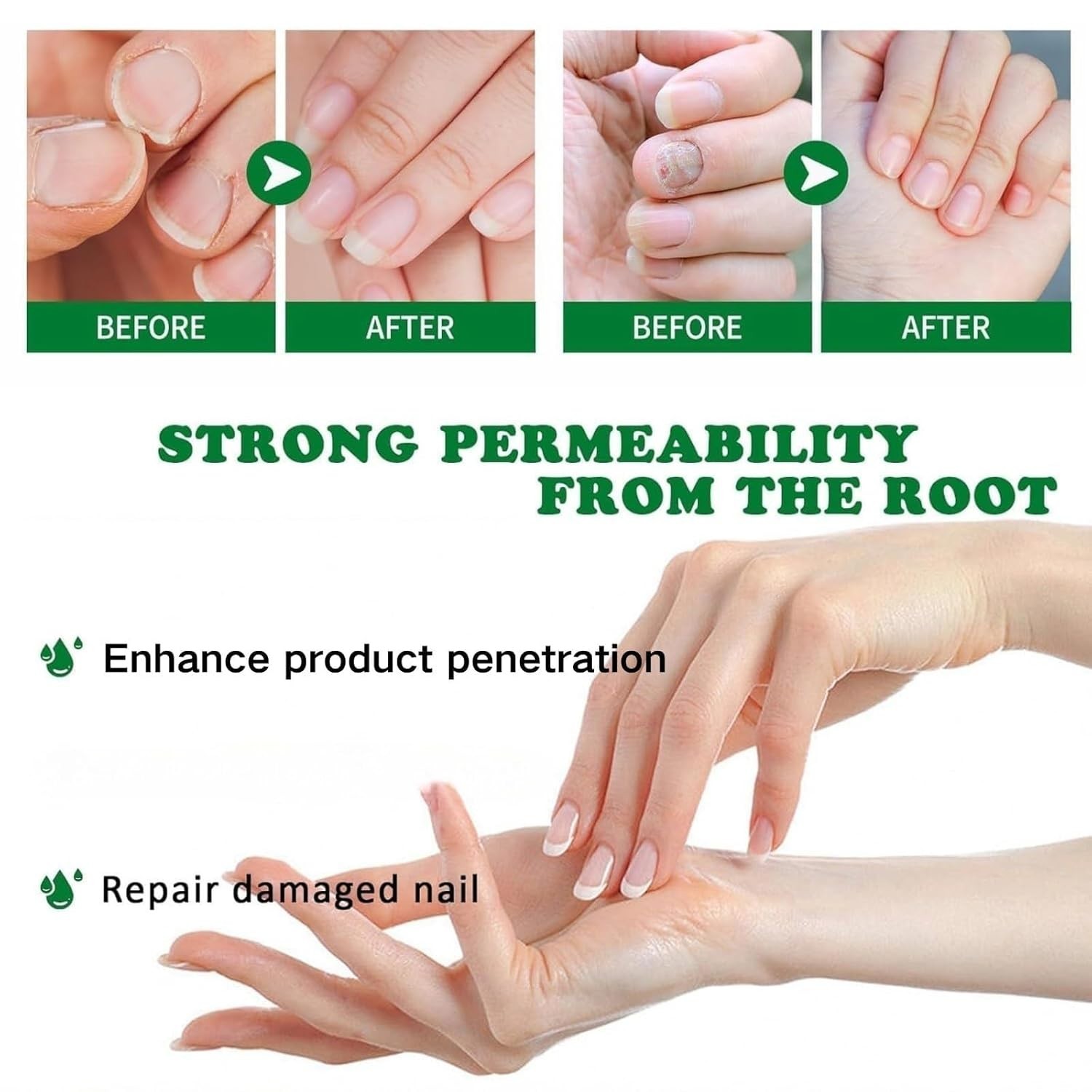 7-Day Toenail Fungus Treatment (2 Pack) Extra Repair for Discolored Nails 30MLx2