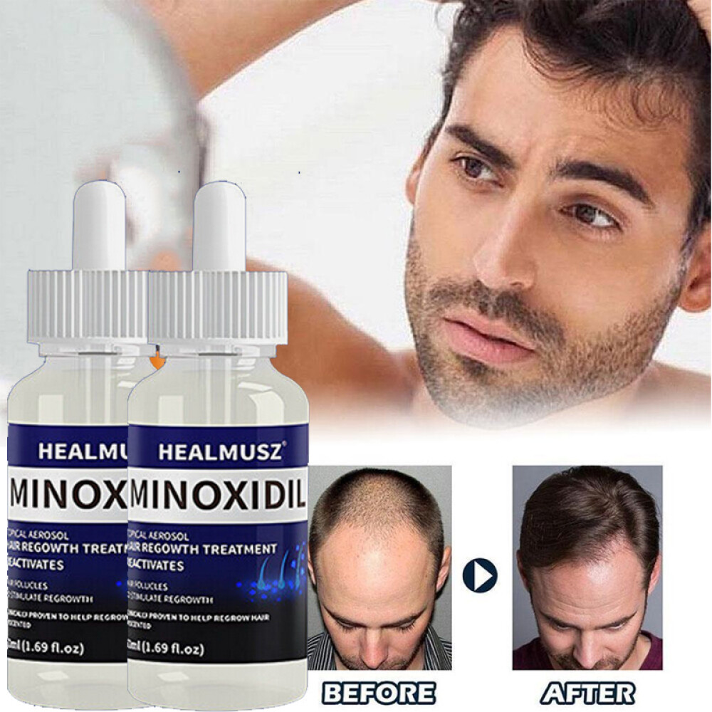 Minoxidil 5% Extra Strength Men 2 Month Supply Hair Regrowth Solution 2 Bottles