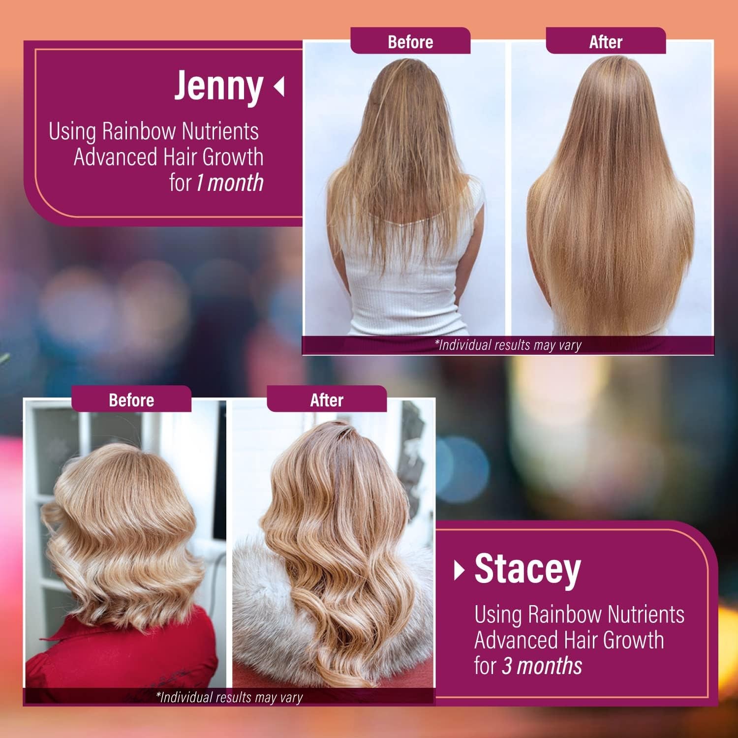 Nutrients Rainbow Advanced Hair Growth-Hair,Dermatological & Nail Health – Bioti