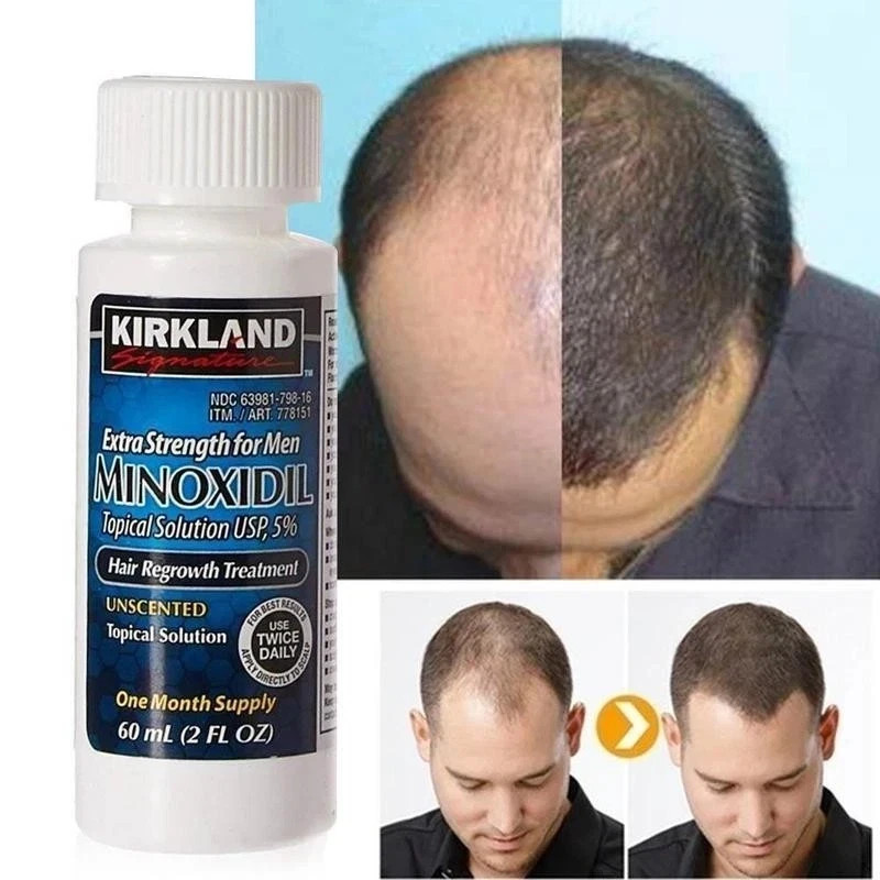 Kirkland Minoxidil 5% Extra Strength Men 6 Month Supply Hair Regrowth