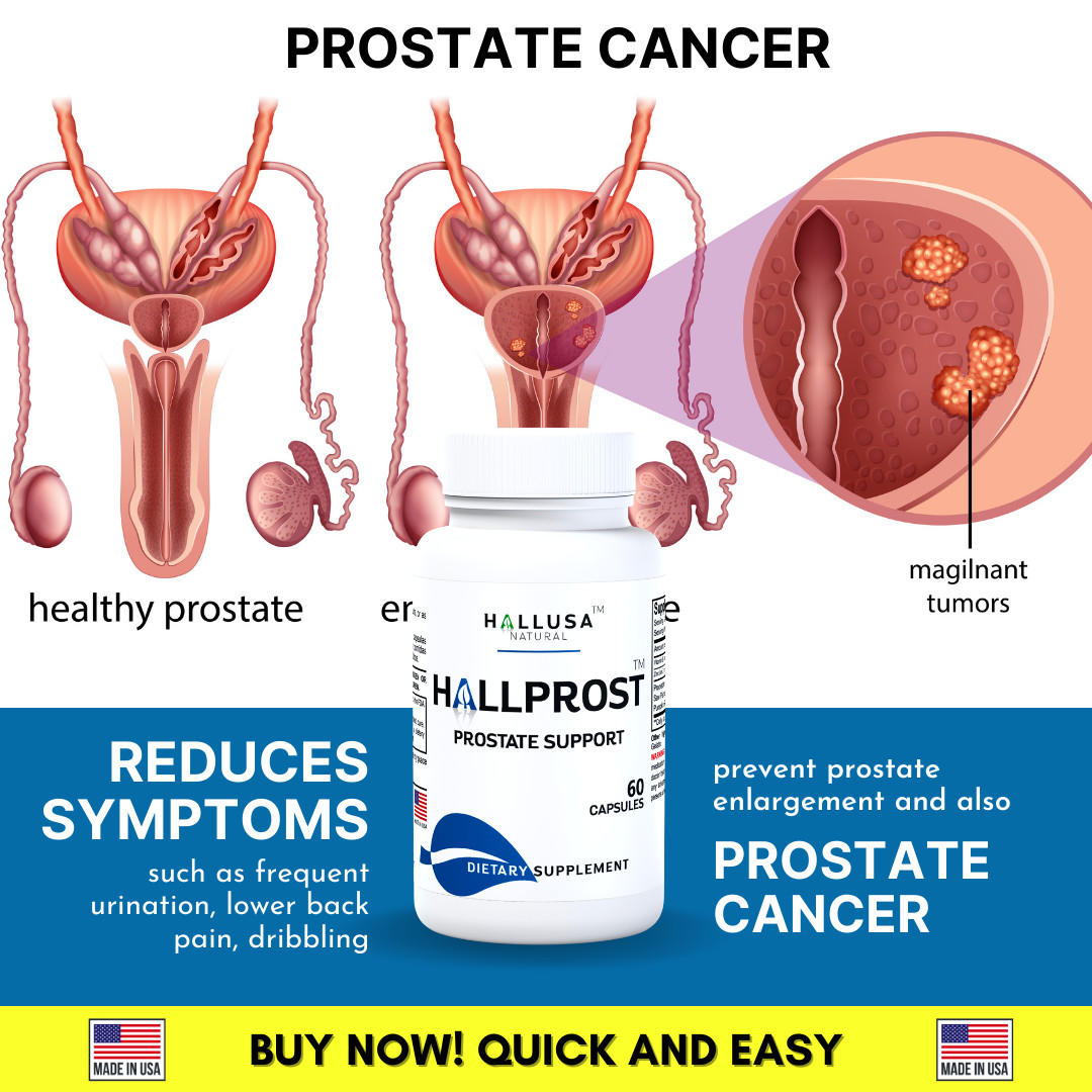 HALLPROST – Inflamed Prostate – Prostatitis – BPH – Urinary Function – 60 Cap