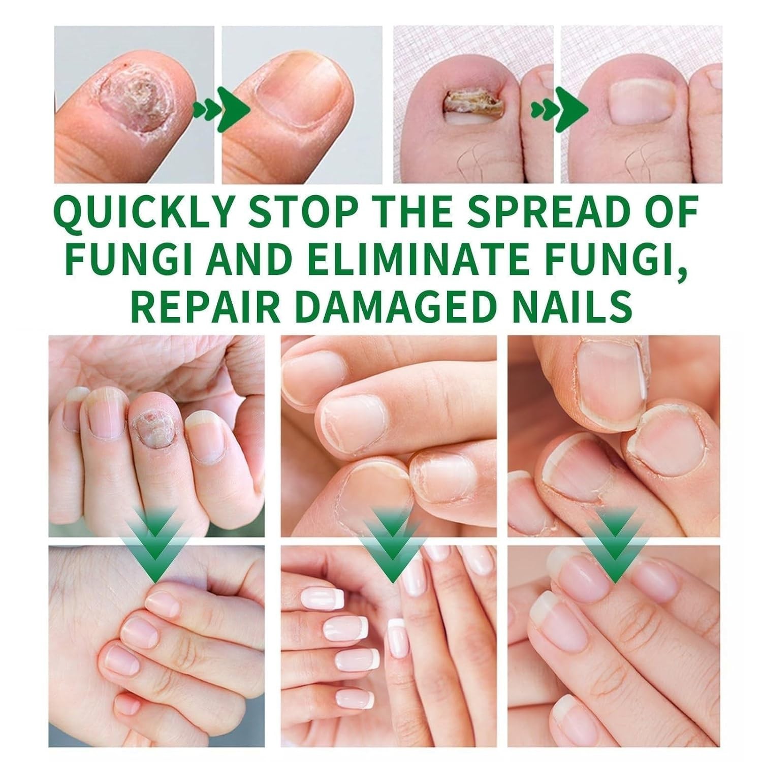 7-Day Toenail Fungus Treatment (2 Pack) Extra Repair for Discolored Nails 30MLx2