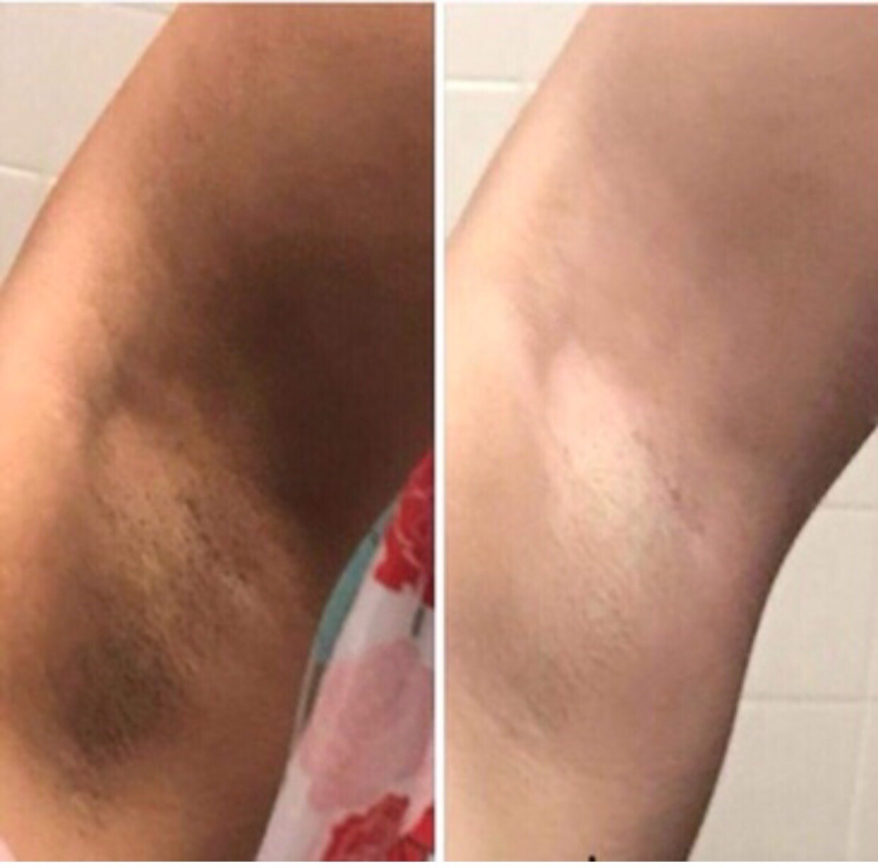 Super Skin Lightener Cream, Eliminan Las Manchas Oscuras Para Piel Clara, 5 oz.