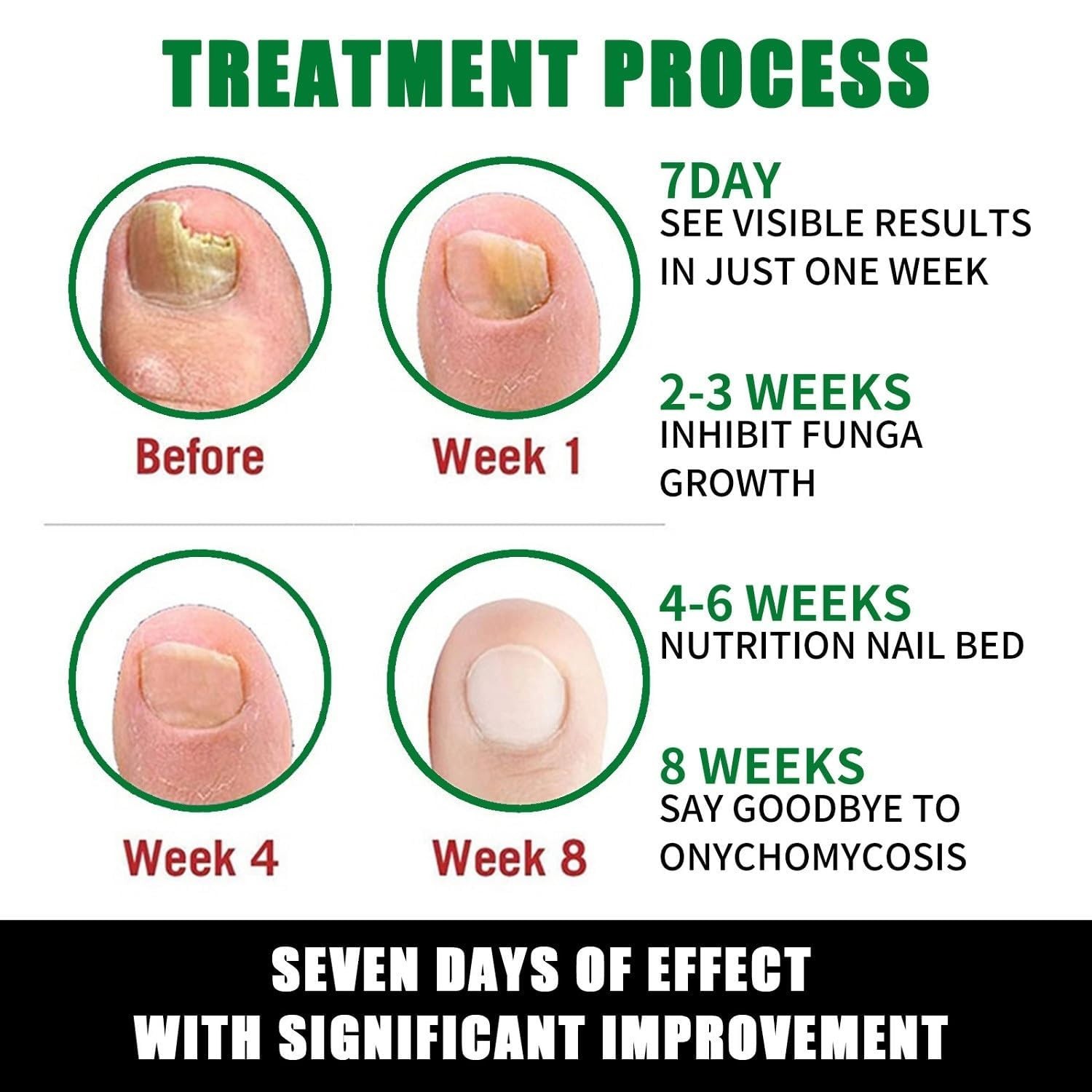 7-Day Toenail Fungus Treatment (2 Pack) Extra Repair for Discolored Nails 30MLx2