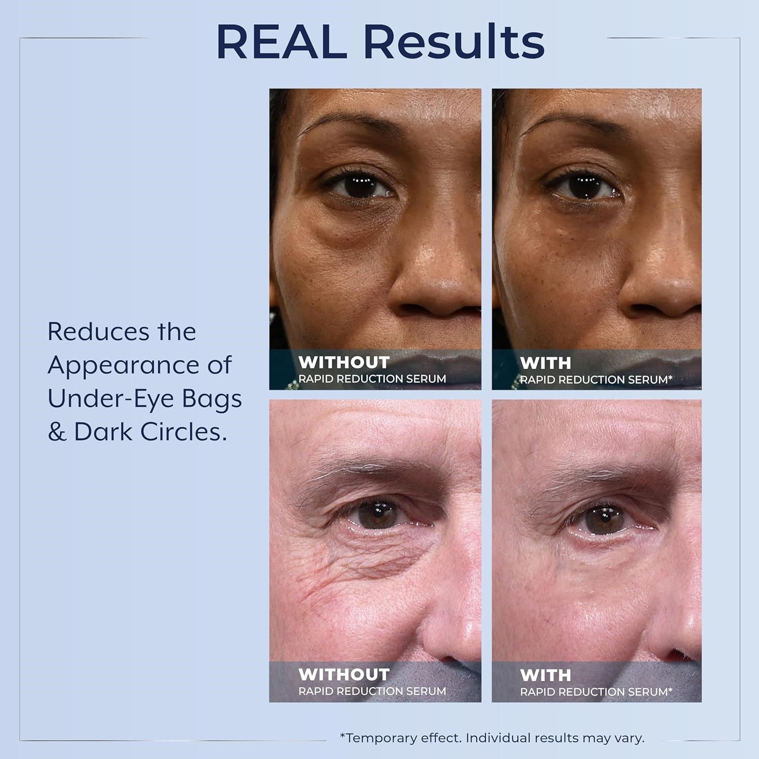 Plexaderm Rapid Reduction Eye Serum – Visibly Reduces Under-Eye Bags, Wrinkles🔥