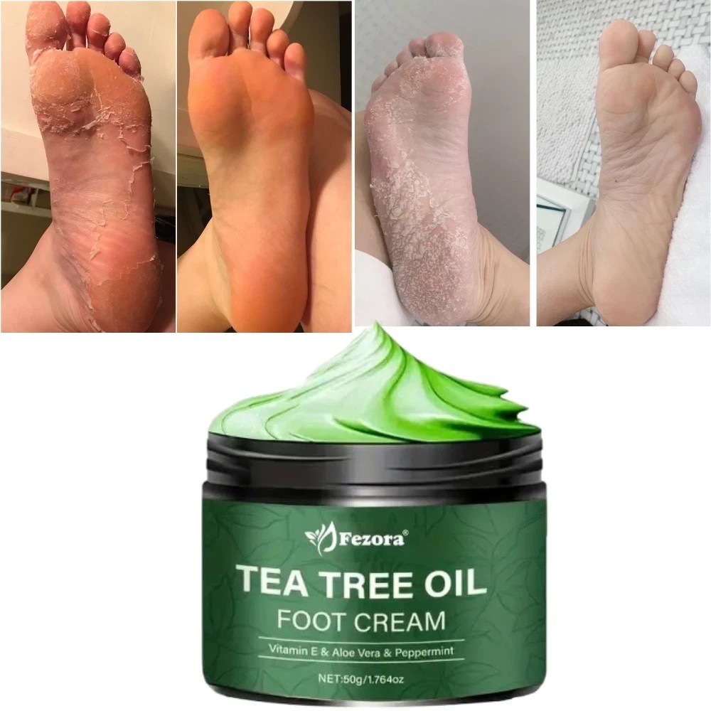 Fezora Tea Tree Foot Cream with Aloe Vera & Vitamin E for deep moisturising 50g