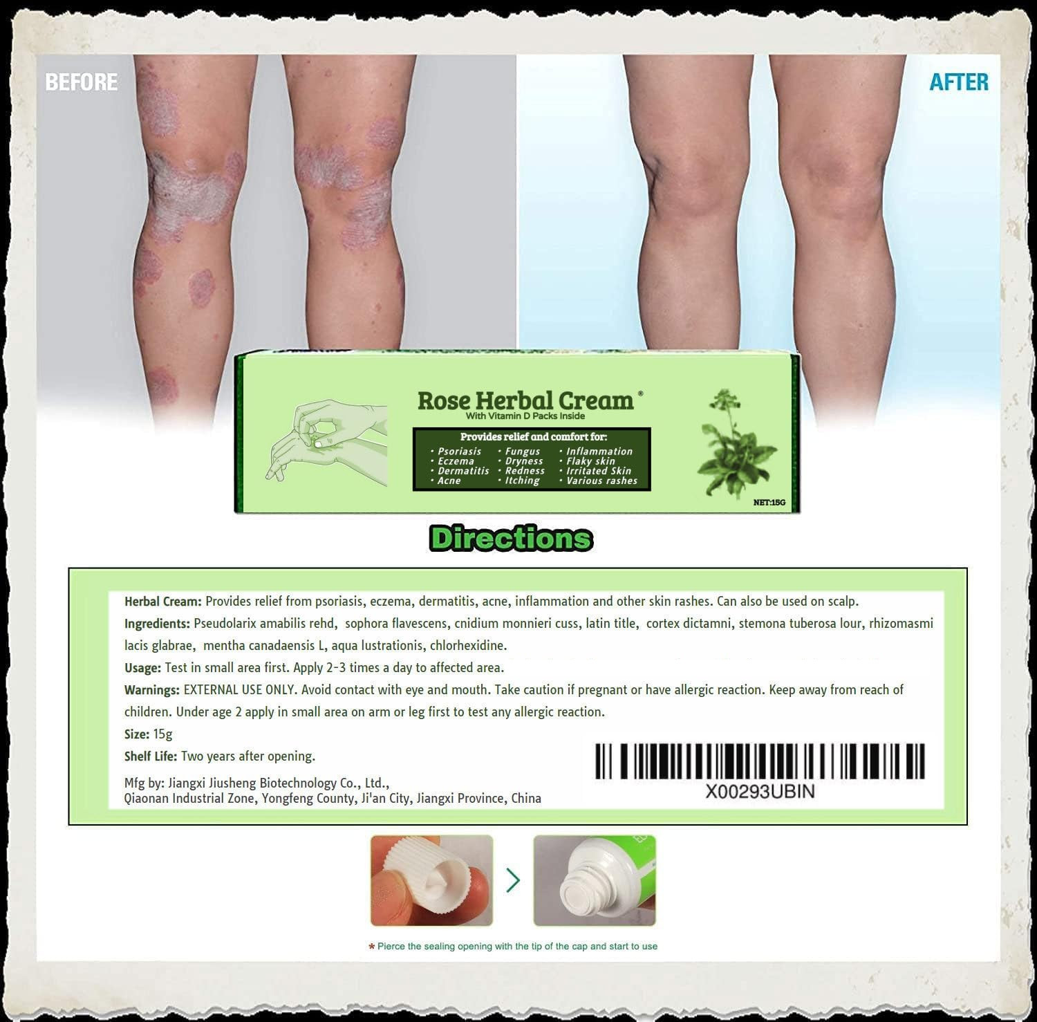 Eczema Psoriasis CREAM Ointment Inflammation Natural Anti Itching Dermatitis
