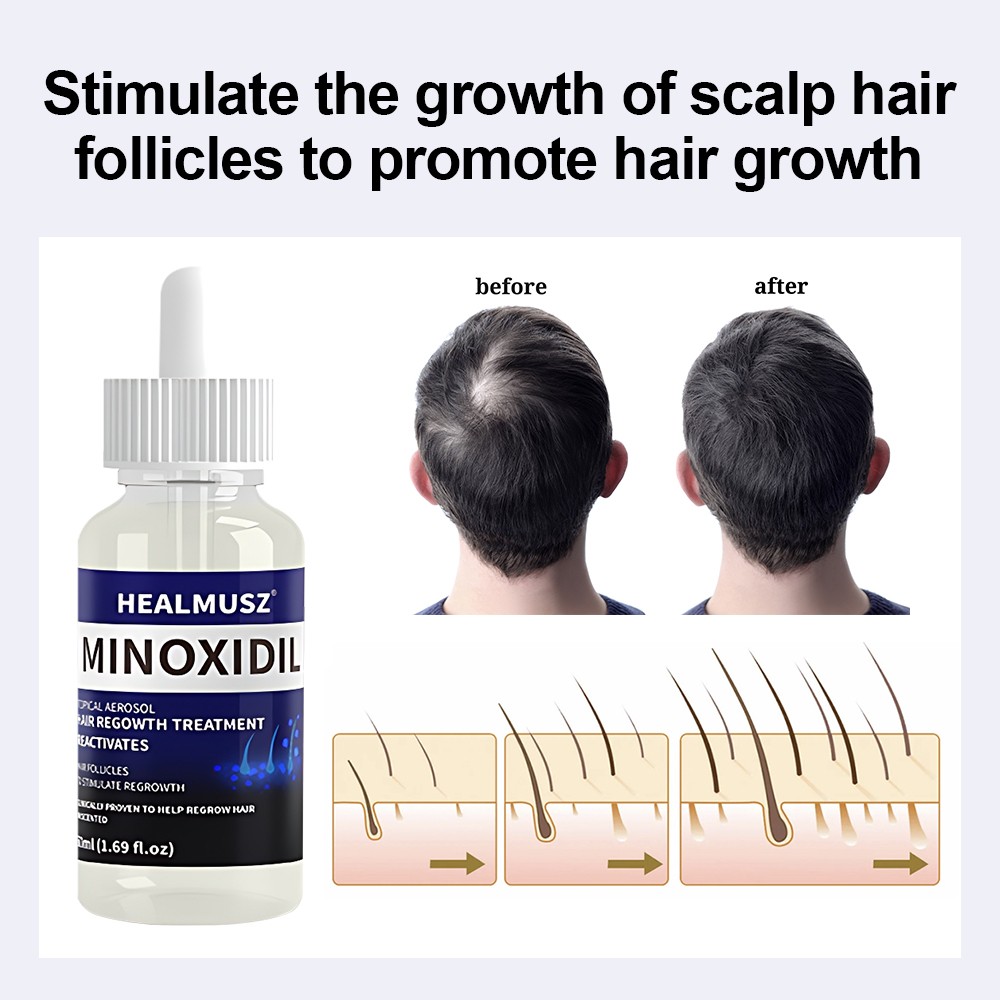 Hair Regrowth Liquid- 5% Minoxidil Topical Solution for Thicker Hair Grow 50ml*2