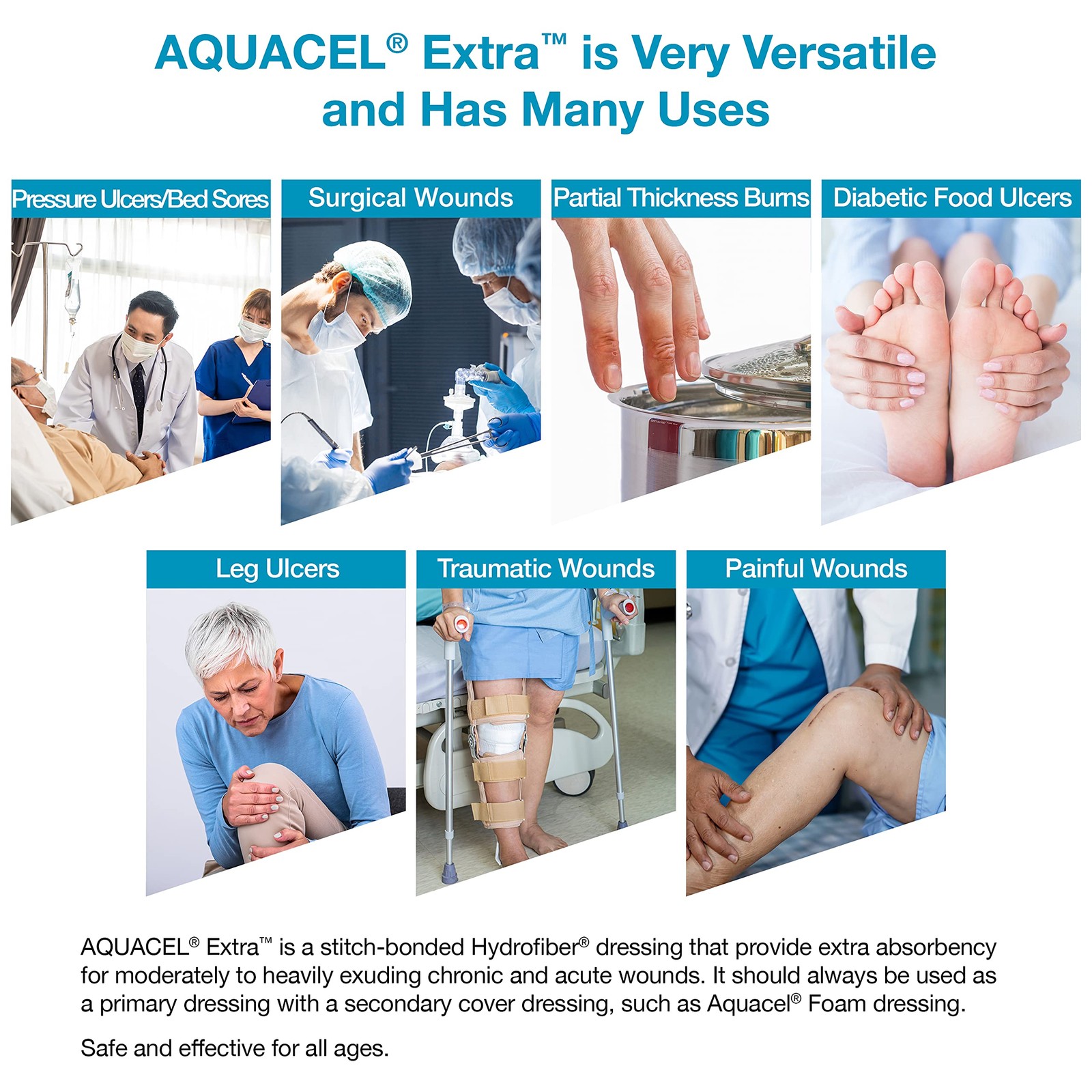 AQUACEL Extra 6″x6″ Hydrofiber Absorbant Dressing for Moderate Highly Exuding