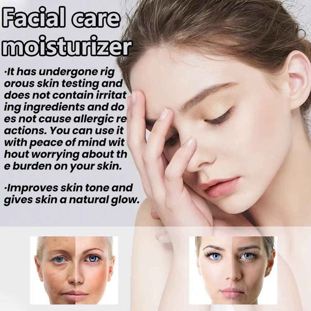 EltaMD UV Clear Face Sunscreen SPF 46 Oil-Free Zinc Oxide Dermatologist Recommen