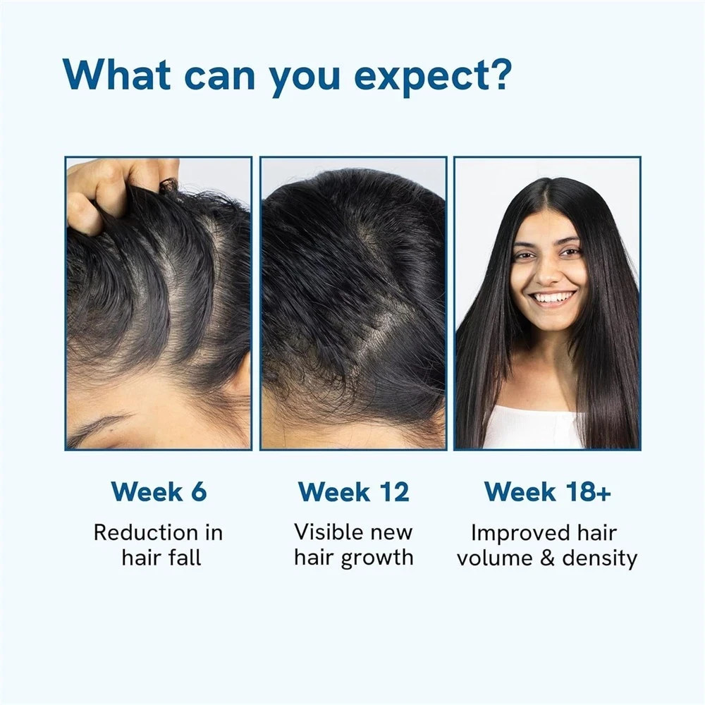 Be Bodywise Hair Growth Serum Roll On – 3% Rosemary, 3% Redensyl & 2% – 2025🔥